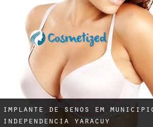 Implante de Senos em Municipio Independencia (Yaracuy)