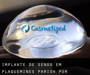 Implante de Senos em Plaquemines Parish por município - página 1