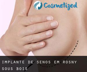 Implante de Senos em Rosny-sous-Bois