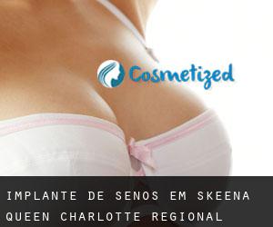 Implante de Senos em Skeena-Queen Charlotte Regional District