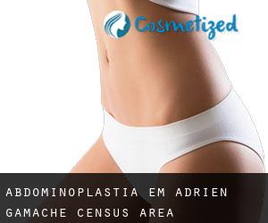 Abdominoplastia em Adrien-Gamache (census area)