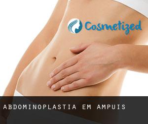 Abdominoplastia em Ampuis