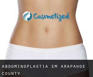 Abdominoplastia em Arapahoe County