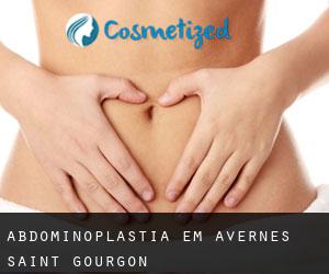 Abdominoplastia em Avernes-Saint-Gourgon