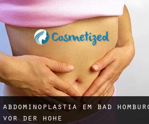 Abdominoplastia em Bad Homburg vor der Höhe