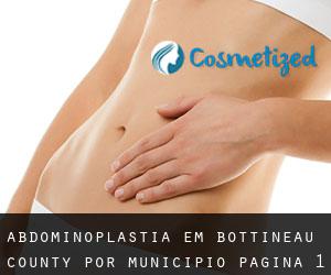 Abdominoplastia em Bottineau County por município - página 1