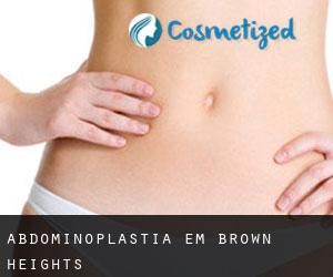 Abdominoplastia em Brown Heights