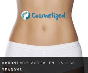 Abdominoplastia em Calebs Meadows