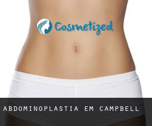 Abdominoplastia em Campbell