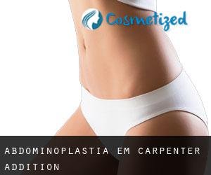 Abdominoplastia em Carpenter Addition
