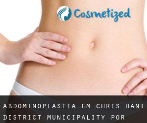 Abdominoplastia em Chris Hani District Municipality por município - página 1