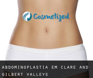 Abdominoplastia em Clare and Gilbert Valleys