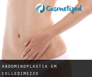 Abdominoplastia em Colledimezzo
