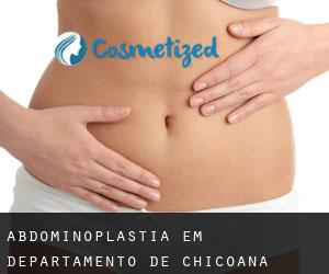 Abdominoplastia em Departamento de Chicoana