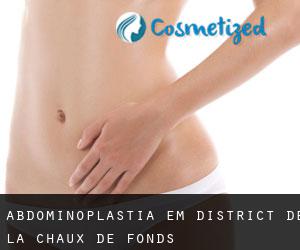 Abdominoplastia em District de la Chaux-de-Fonds