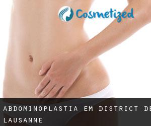 Abdominoplastia em District de Lausanne