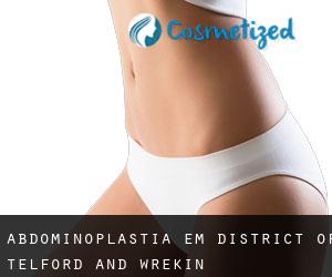 Abdominoplastia em District of Telford and Wrekin