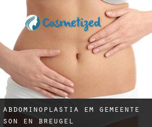 Abdominoplastia em Gemeente Son en Breugel