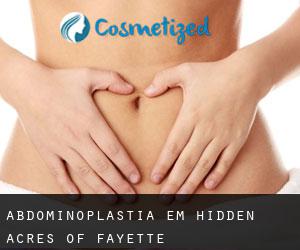 Abdominoplastia em Hidden Acres of Fayette