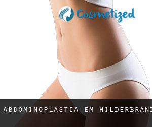 Abdominoplastia em Hilderbrand