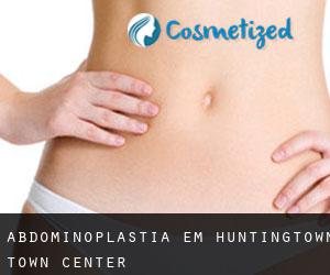 Abdominoplastia em Huntingtown Town Center