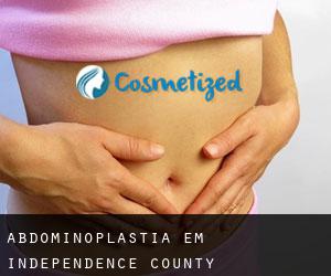 Abdominoplastia em Independence County