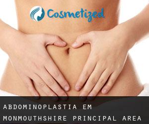 Abdominoplastia em Monmouthshire principal area por município - página 1