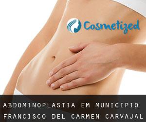 Abdominoplastia em Municipio Francisco del Carmen Carvajal