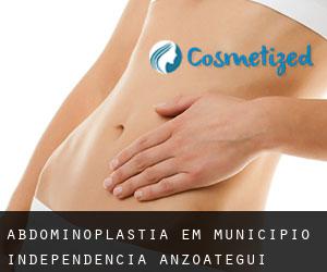 Abdominoplastia em Municipio Independencia (Anzoátegui)