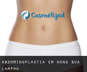 Abdominoplastia em Nong Bua Lamphu