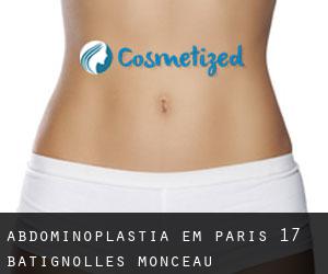 Abdominoplastia em Paris 17 Batignolles-Monceau
