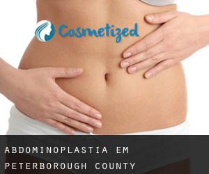 Abdominoplastia em Peterborough County