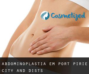 Abdominoplastia em Port Pirie City and Dists Abdominoplastia em Port Pirie City and Dists