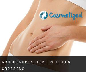 Abdominoplastia em Rices Crossing