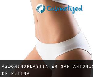 Abdominoplastia em San Antonio De Putina