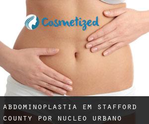 Abdominoplastia em Stafford County por núcleo urbano - página 1