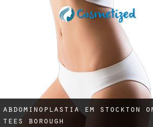 Abdominoplastia em Stockton-on-Tees (Borough)
