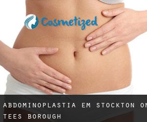 Abdominoplastia em Stockton-on-Tees (Borough)