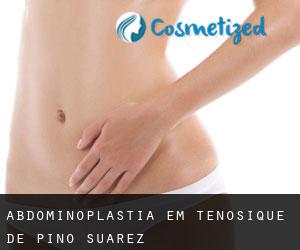 Abdominoplastia em Tenosique de Pino Suárez