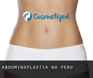 Abdominoplastia no Peru