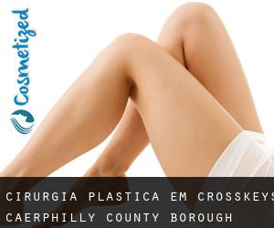 cirurgia plástica em Crosskeys (Caerphilly (County Borough), Wales)