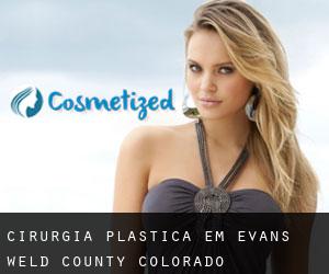 cirurgia plástica em Evans (Weld County, Colorado)
