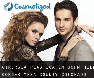 cirurgia plástica em John Held Corner (Mesa County, Colorado)