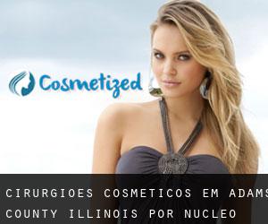 cirurgiões cosméticos em Adams County Illinois por núcleo urbano - página 1
