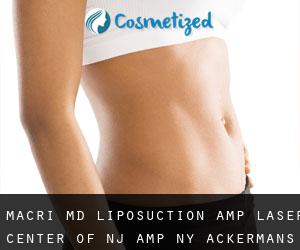 Macri MD Liposuction & Laser Center of NJ & NY (Ackermans Mills) #5